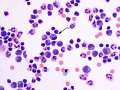 Mott cell