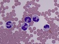 Mycobacteria