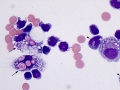 Intracellular myelin