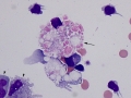 Intracellular myelin