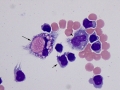 Intracellular myelin