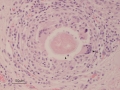 Parelaphostrongylus tenuis (calf)
