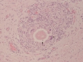 Parelaphostrongylus tenuis (calf)