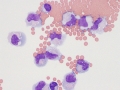 Herpesvirus