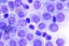 "Discrete" cell tumors