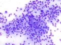 Histiocytic sarcoma (dog)