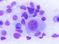 Histiocytic sarcoma (dog)