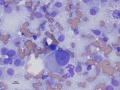 Histiocytic sarcoma (dog)