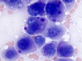 Histiocytic tumor (globular variant, cat)