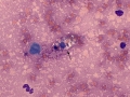 Mast cell tumor