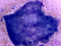 Necrotic muscle (mast cell tumor)