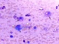 Mast cell tumor