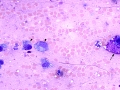 Mast cell tumor