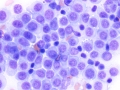 Transmissible venereal tumor (TVT, DQ)