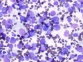 Lymphoma (DQ, cat)