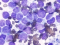 Lymphoma (DQ, cat)