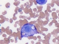 Mast cell tumor