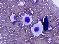 Mast cell tumor (DQ)