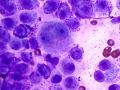 Mast cell tumor