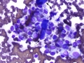 Histiocytoma (DQ)