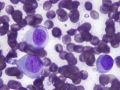 Histiocytoma (DQ)