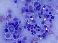 Histiocytoma (DQ)
