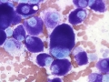 Mast cell tumor