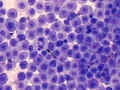 Mast cell tumor (DQ, cat)