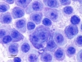 Mast cell tumor (DQ, cat)