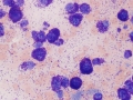 Mast cell tumor