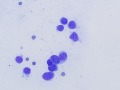 Cutaneous plasmacytosis (rapid stain)