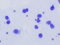 Cutaneous plasmacytosis (rapid stain)