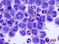 Mitotic figures