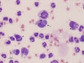 Methylcellulose