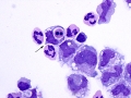 Leukophagia