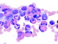 Macrophages & eosinophils