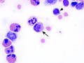 Macrophage with purple granules
