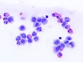 Macrophages & eosinophils