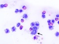 Mitotic figure