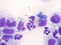 Partial enterocentesis