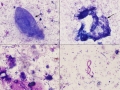 Enterocentesis