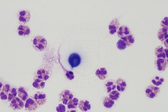 Infectious agents (cytology)