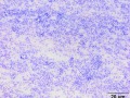 Cryptococcus & bacteria (dog)