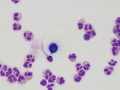 Cryptococcus