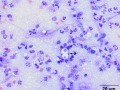 Cryptococcus & bacteria (dog)