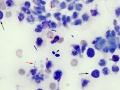 Mixed GI flora & yeast