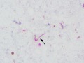 Listeria (cat, IHC)
