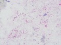 Listeria (cat, IHC)