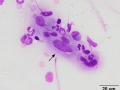 Mycoplasma