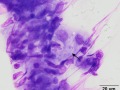 Mycoplasma
